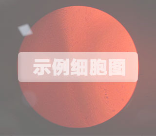 人原代角質(zhì)形成細(xì)胞